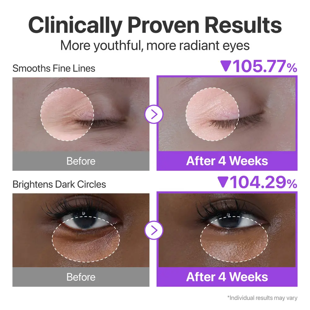 کرم دور چشم ضد چروک +NAD و رتینول شماره 9 نامبوزین